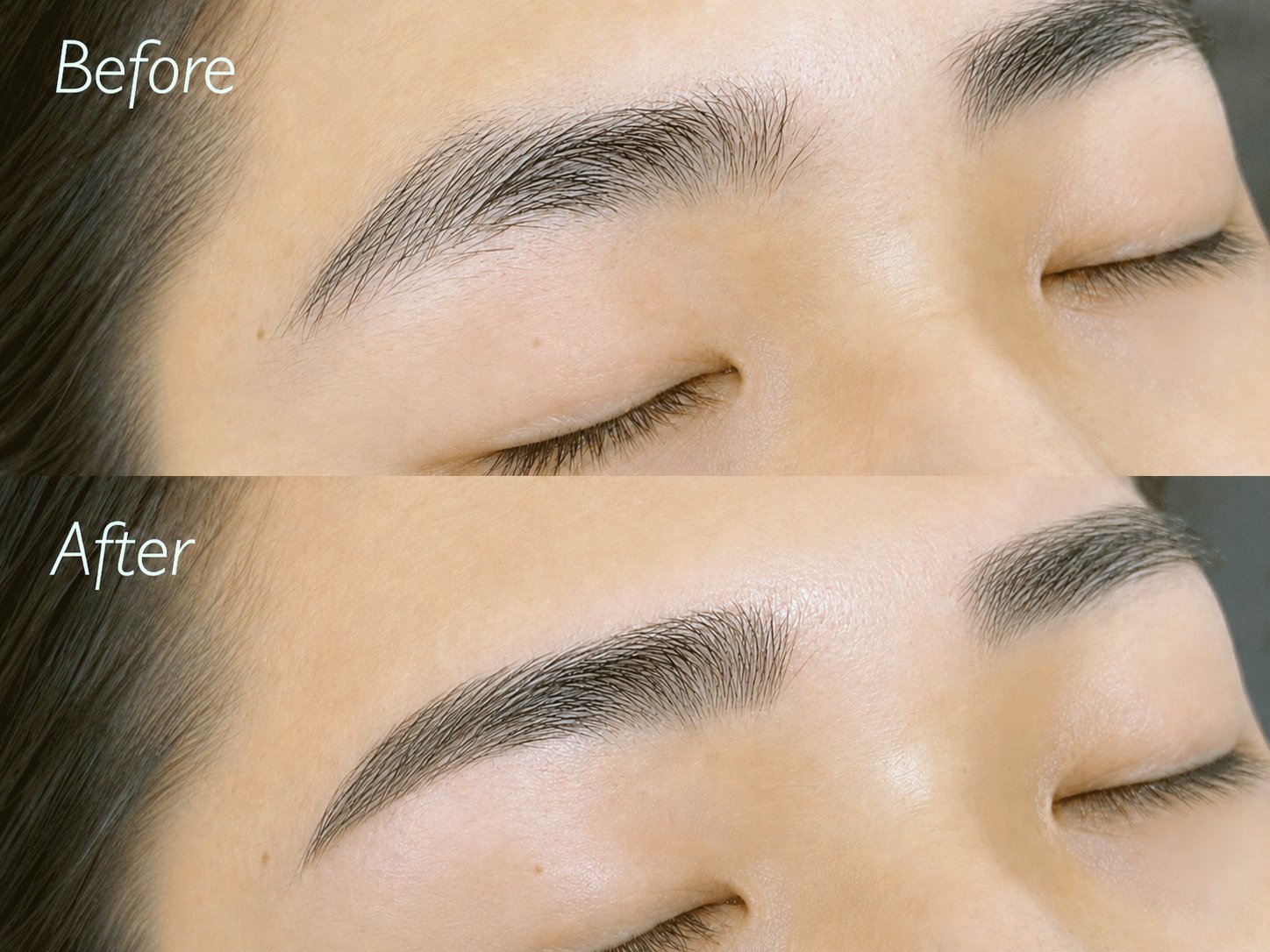男性の施術例(Before / After)
