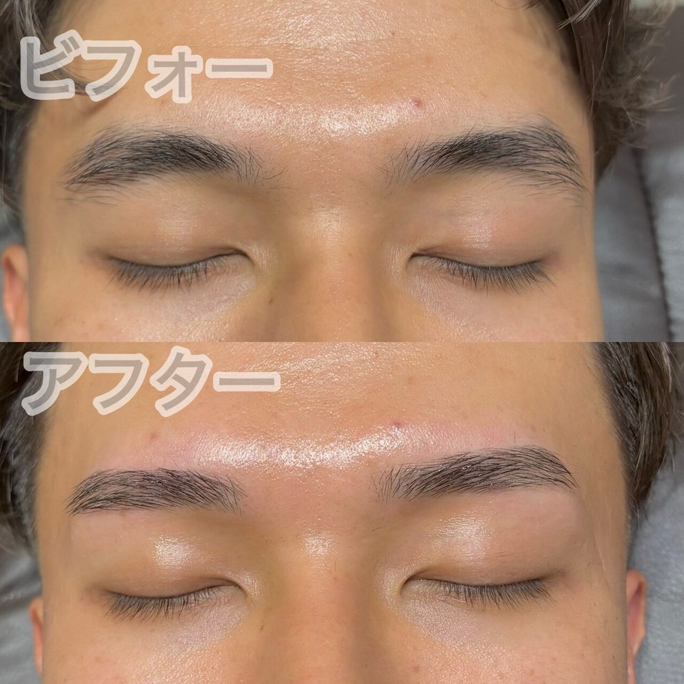 目を閉じた男性の目元を上下に並べた写真。上（ビフォー）は眉頭に左右差がある眉、下（アフター）は整えた後の眉