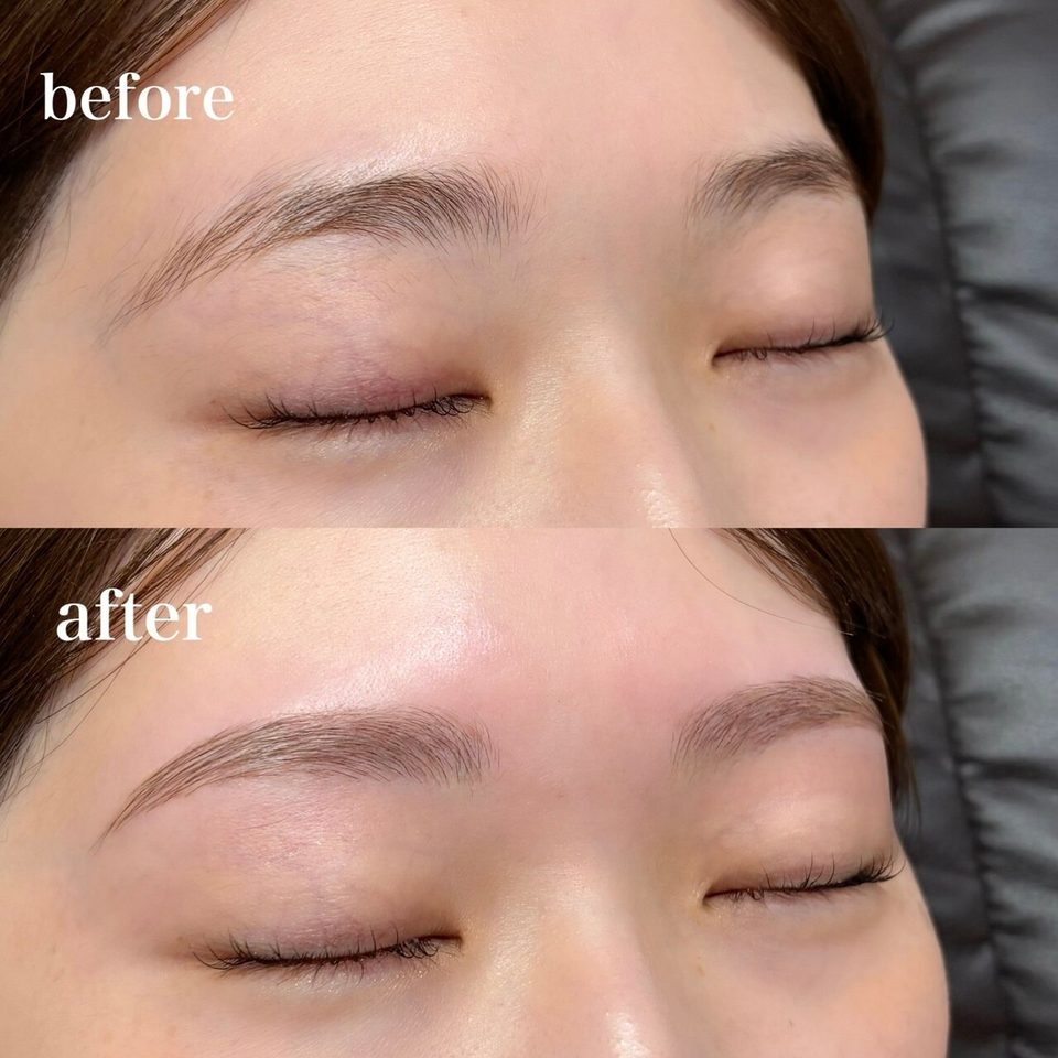 目を閉じた目元を上下に並べた写真。上(before)は間引きの前の眉、下(after)は間引きで濃さを整えた後の眉