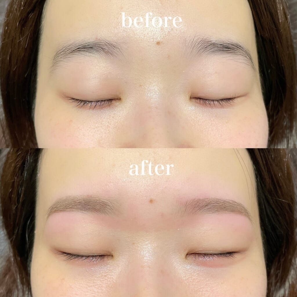 目を閉じた目元を上下に並べた写真。上(before)は整える前の下がり気味の眉、下(after)は必要な産毛を残して整えた眉
