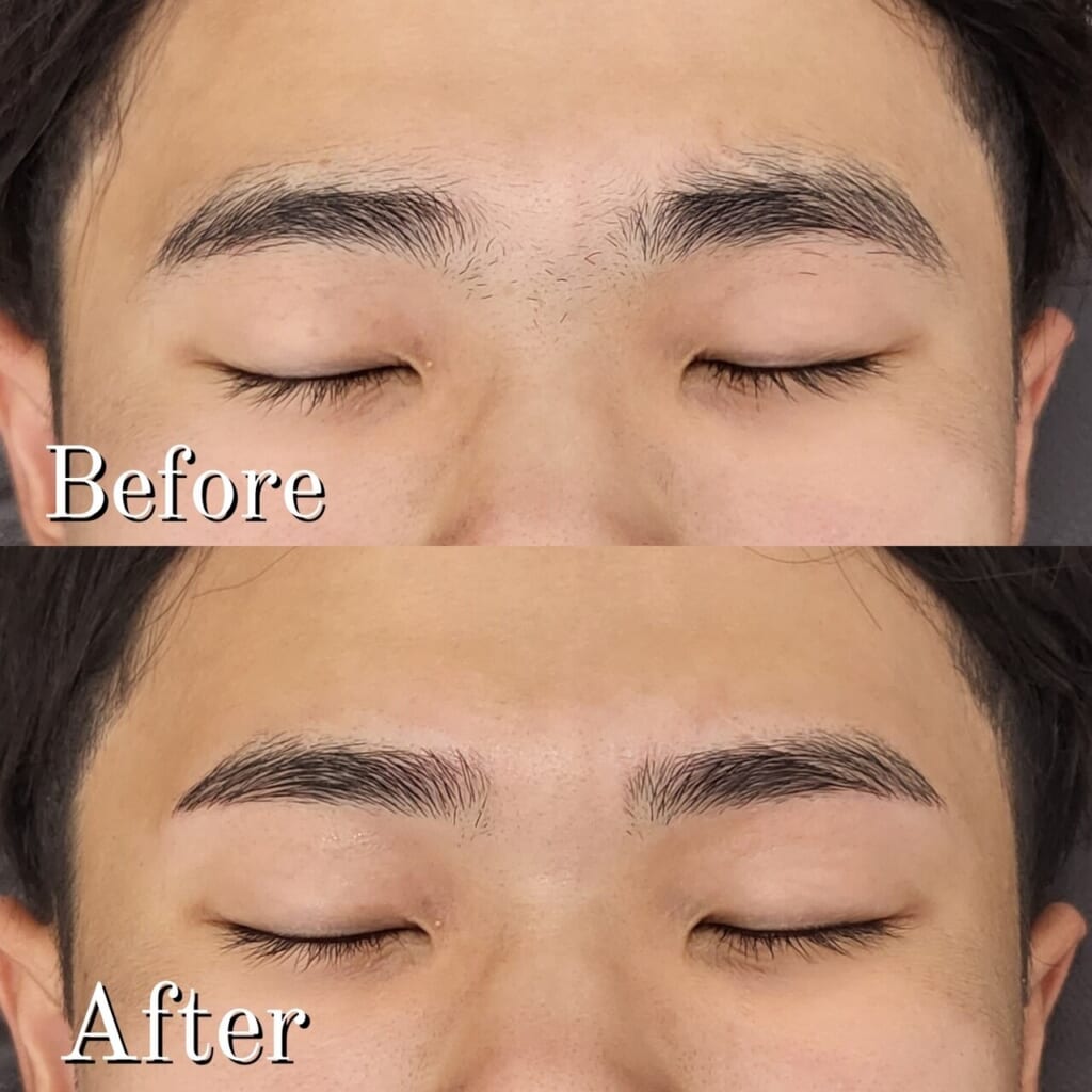 目を閉じた目元を上下に並べた写真。上(Before)は自己処理で眉の上を削っていた眉、下(After)は伸ばしながら形を整え始めた眉