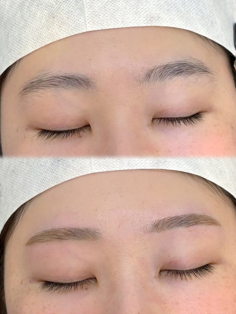 目を閉じた目元を上下に並べた写真。上は整える前の眉、下は眉山に角度をつけすぎず、なだらかなカーブにしたゆるアーチ眉