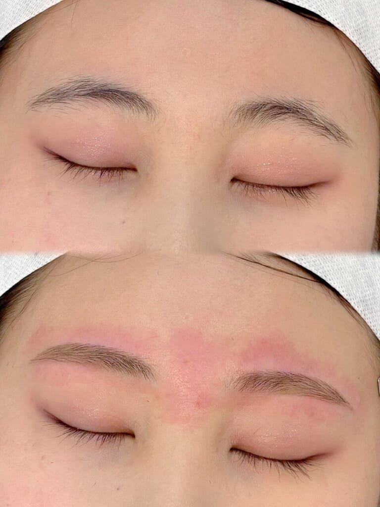 目を閉じた目元を上下に並べた写真。下は、眉山にゆるやかな丸みをつけて整えた眉