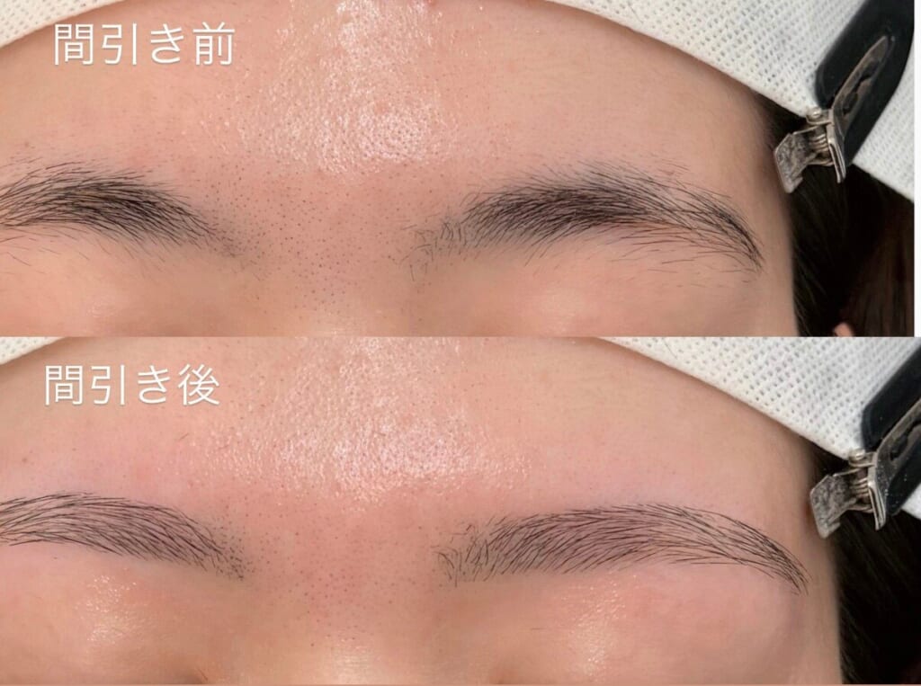 眉の間引き前と間引き後を上下に並べた写真